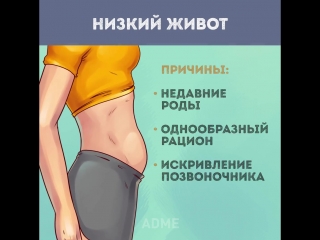 types of abdomen are not from excess weight